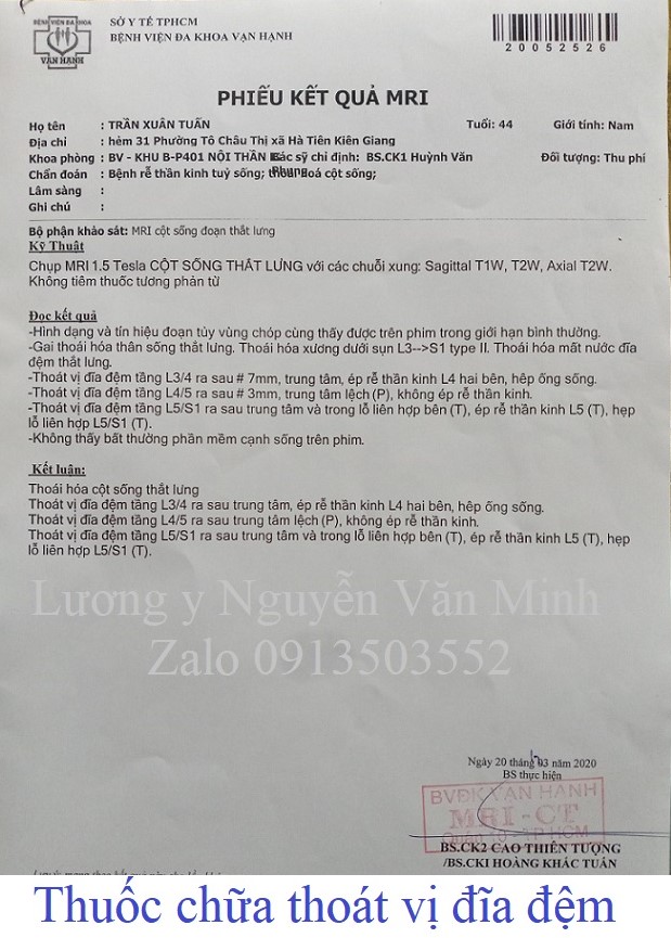 Thoát vị đĩa đệm L3/4, L4/5, L5/S1